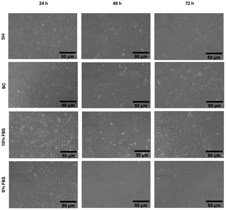 Morphology of C2C12 cells cultured in media supplemented with 11.7 mg/mL of SH (shrimp), BC (blue crab), 10% FBS (fetal bovine serum) and 0% FBS after 24 and 48 and 72 h. Images were acquired at 10× magnification.
