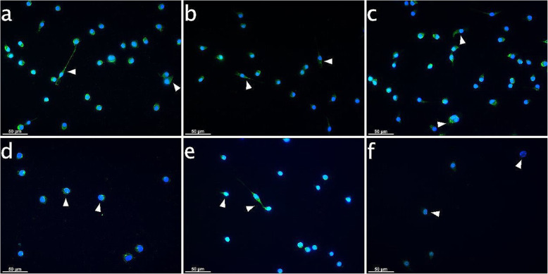 IBA-1 expression in microglia subject to CB receptor agonist modulation with or without CII for 6 h. Immunocytochemical analyses for IBA-1 (green) after stimulation for 6 h in cultured Embryonic stem cell-derived microglia (ESdM) cells. The IBA-1 signals were distributed equally in the cytoplasm for controls and with endocannabinoid treatment (arrowheads on Fig. a, b, c). CII induced loss of cells. IBA-1 MFI values increased in the CII and the CII plus AEA group (arrowheads on Fig. d, e). In the specimes exposed to CII plus PEA, IBA-1 signals dimished (arrowheads on Fig. f). a: Control, b: AEA-treated (50 μM), c: PEA-treated (50 μM), d: 6 h CII, e: 6 h CII plus AEA-treated (50 μM), f: 6 h CII plus PEA-treated (50 μM). Visualization was performed with Alexa 488 (green) secondary antibody. Nuclei were stained with DAPI (blue). Scale bar is 50 μm