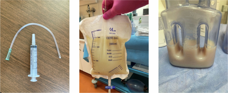 (Left) A 20 ml syringe with a rigid plastic tube used for the oral drug administration deep into the throat. (Middle) A urinary bag with a large amount of porcine lymph collected overnight. (Right) A 200 ml Redon bottle with a 1-h lymph sample.