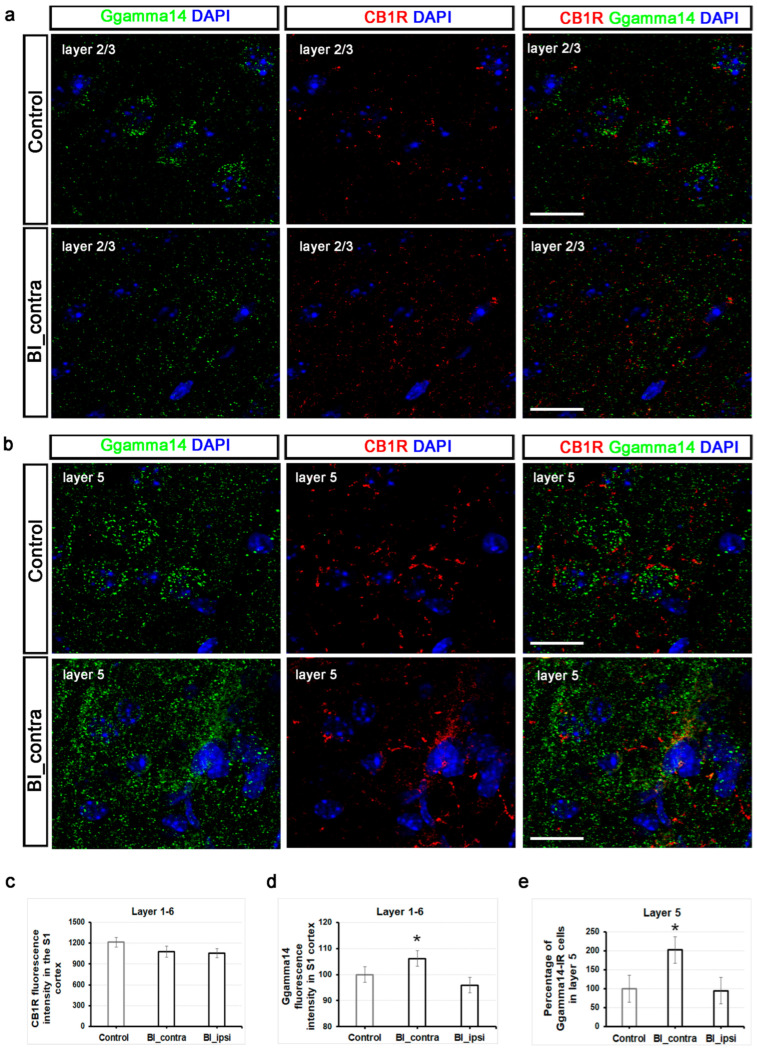Validation of RNA-seq datasets using immunofluorescence: increased Ggamma14 fluorescence intensity and a higher number of Ggamma14-IR cells in the S1 cortex post-burn injury. (a) Representative triple immunofluorescent labeling of the S1 cortex in a control mouse (top) and a mouse subjected to burn injury (bottom) are shown, utilizing antibodies against the CB1R (red), Ggamma14 (green), and DAPI (blue) in layer 2/3. Scale bar: 10 µm. (b) Representative triple immunofluorescent labeling of the S1 cortex in a control mouse (top) and a mouse subjected to burn injury (bottom) are shown, utilizing antibodies against the CB1R (red), Ggamma14 (green), and DAPI (blue) in layer 5. Scale bar: 10 µm. (c) Quantitative analysis of CB1R fluorescence intensity throughout the entire thickness of the contralateral S1 cortex, relative to the control. The data are presented as mean ± SEM (n = 5–8 sections from 2 animals per group). (d) Quantitative analysis of fluorescence intensity for Ggamma14-IR throughout the entire thickness of the S1 cortex was normalized to the control. The data are presented as mean ± SEM (n = 3–5 sections from 2 animals per group). An asterisk (*) indicates p < 0.05 vs. controls. (e) Quantitative analysis of the percentage of Ggamma14-IR cells in layer 5 of the S1 cortex, relative to the control. The data are presented as mean ± SEM (n = 3–5 sections from 2 animals per group). An asterisk (*) indicates p < 0.05 vs. controls.