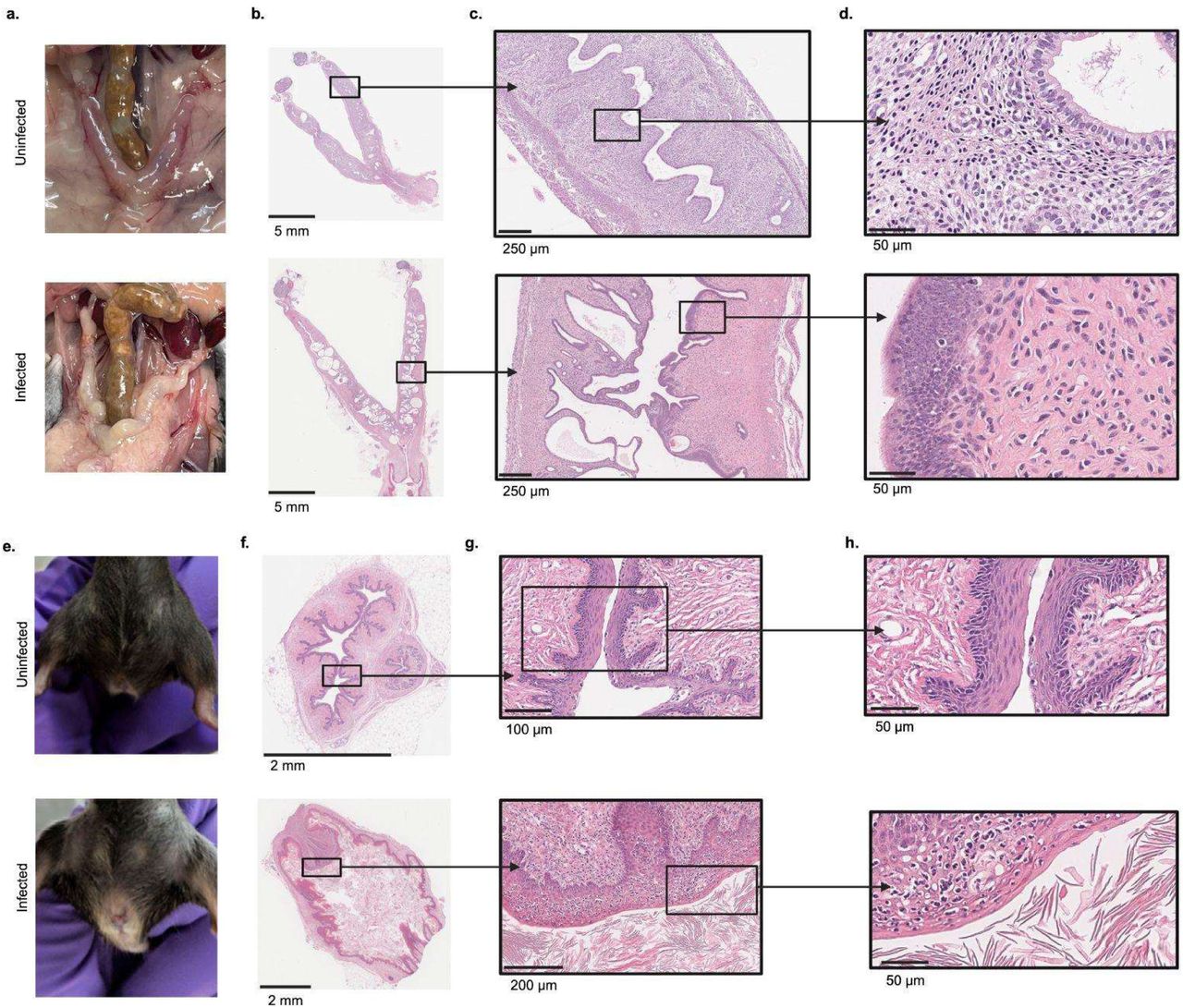Gynecological pathologies of the infected murine uterus and vagina.A. Gross pathology images of representative murine female reproductive tracts from B6 mice 12-months post-injection that were either uninfected or infected intraperitoneally with 105 GFP-B. burgdorferi at 8-weeks of age. Hematoxylin and eosin (H&E) histology of murine female reproductive tracts sectioned longitudinally from B6 mice shown in panel A, at different magnifications where scale bar = 5mm (panel B), 250 um (panel C), and 50 um (panel D). E. Representative images of the external genitalia of B. burgdorferi-infected and uninfected female aged, reproductively senescent and breeding-naïve B6 mice. Transversal sections of the vagina at different magnifications (F=2 mm, G=100 µm (top) and 200 µm (bottom), H=50 µm). N=1 out of 5 uninfected and N=1 out of 3 infected representative uteri and vaginas are shown.