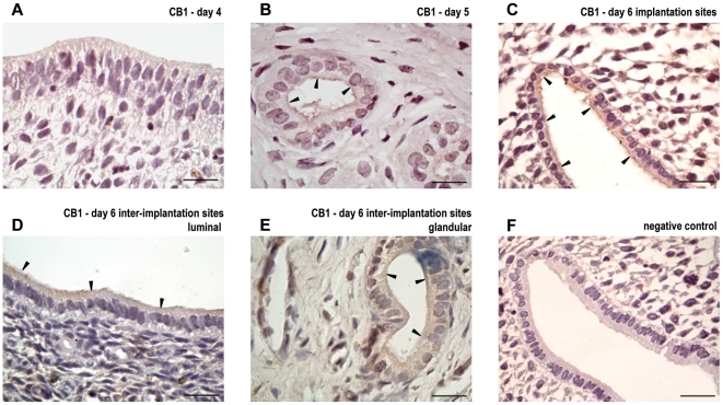 Localization of cannabinoid receptor type 1 during implantation.Immunolocalization of cannabinoid receptor type-1 (CB1) in uteri from day 4 (A), day 5 (B), day 6 implantation sites (C) and day 6 inter-implantation sites (D: luminal, E: glandular). Tissue sections were processed by the immunoperoxidase technique using a polyclonal antibody directed against CB1. No staining was observed in the luminal and glandular epithelium when the first antibody was omitted (F). Black arrows denote specific staining. The scale bar indicates 20 µm.
