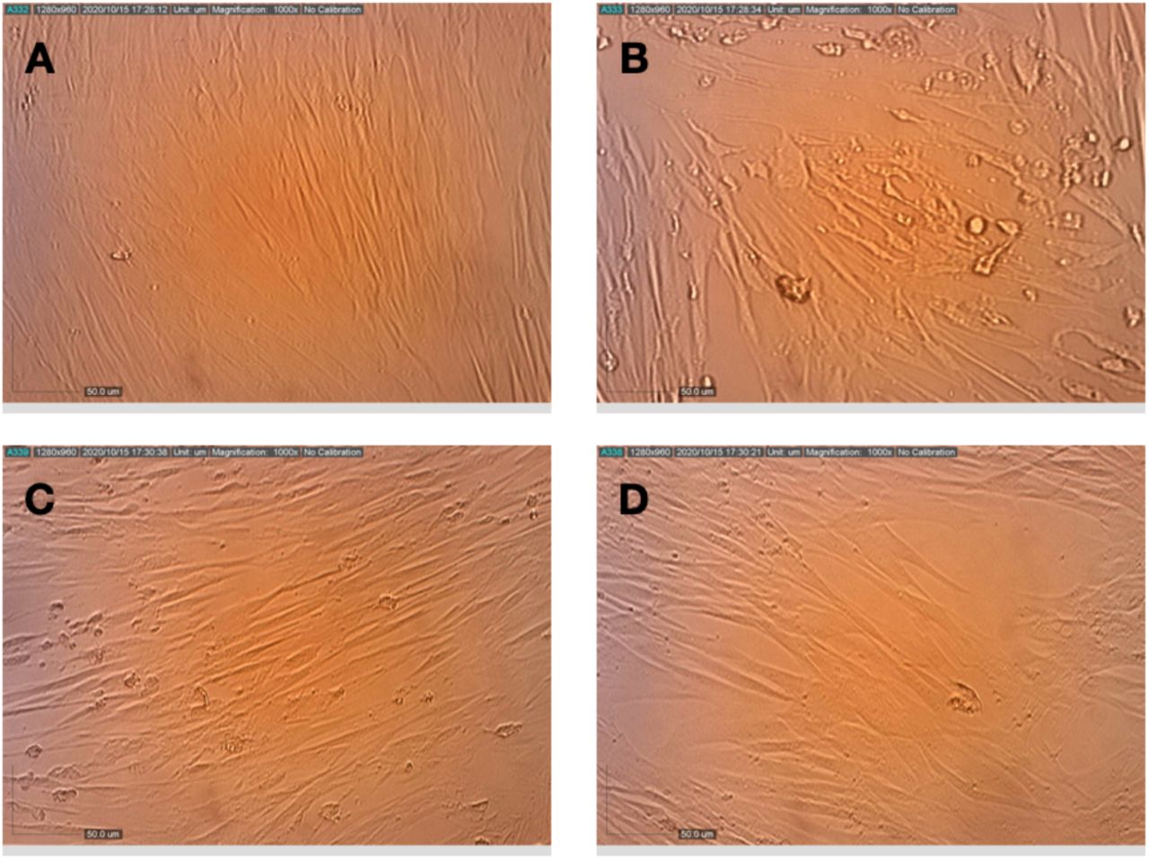 Effects of terpenes and CBD applied post-infection on the replication and cytopathic effect of HCoV-229E in MRC-5 cells. (A) Healthy MRC-5 cells, (B) MRC-5 cells at 72 h after infection with HCoV-229E, (C) MRC-5 cells that were pretreated with terpenes, photographed 72 h after infection with HCoV-229E and (D) MRC-5 cells that were pretreated with terpenes and CBD, photographed 72 h after infection with HCoV-229E.