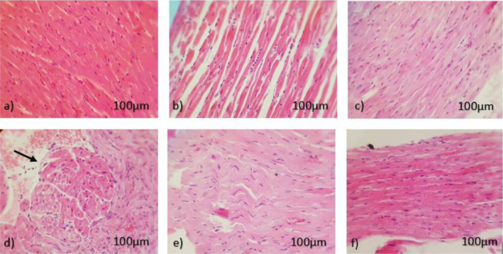 Histological appearance of heart sections stained with hematoxylin and eosin. (Magnification of 40×, light microscopy), (n = 5). (a) Non‐cancerous control (normal saline), (b) cancerous control (normal saline), (c) CBD (5 mg/kg), (d) DOX (5 mg/kg) showing mild inflammation (black arrow), (e) pretreatment CBD (5 mg/kg) 1 day before DOX (5 mg/kg), (f) CBD + DOX (both 5 mg/kg).