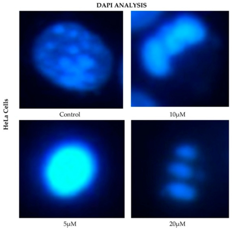 DAPI fluorescence in HeLa cell line treated for 24 h with different concentrations of CBD and controls. Treatments included 5, 10, and 20 μM of CBD and culture medium (control). Scale bar: 10 μm.