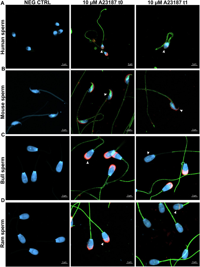 CB1 head spots are present in mammalian sperm before and after the acrosome reaction.Representative confocal images of human (A), mouse (B), bull (C), and ram (D) sperm. Negative controls confirm the absence of CB1 signal in sperm processed without the primary antibody. CB1 head spots (green, indicated by white arrowheads) were visible in sperm with an intact acrosome (red) and persist after the acrosome reaction. Nuclei were counterstained with DAPI (blue). Scale bar: 5 µm.