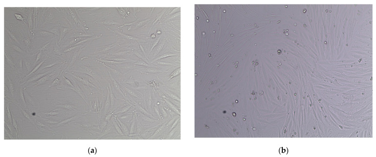 Images depicting L6 skeletal muscle myoblasts from rats, differentiated into L6 skeletal muscle myotubes (passage 7). (a) Myoblasts obtained on day 3 of the tissue culture in 10% FBS Ham F-10 media (10×). (b) Cells obtained on day 4 of the tissue culture in 6% horse serum Ham F-10 media (10×). (c) Myotubes obtained on day 5 of the tissue culture in 2% horse serum Ham F-10 media (10×). (d) Myotubes obtained after 4 h of tissue culture in 2% delipidated serum Ham F-10 media (10×). (e) Myotubes obtained after one hour of cell starvation in only Ham F-10 media (10×). (f) Myotubes obtained after 19 h of cell starvation in only Ham F-10 media (10×).