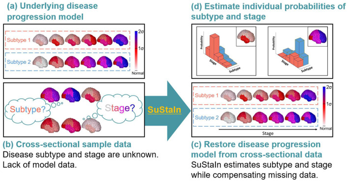 Conceptual overview of SuStaIn modeling. Assuming the underlying model (a), cross-sectional sample data contained biomarker measurements from each subject with an unknown disease subtype and stage (b). SuStaIn restored disease subtypes and temporal progression via simultaneous clustering and disease progression modeling (c). Moreover, SuStaIn estimated the probability that a subject belonged to each subtype and stage based on a reconstructed snapshot (d). The color of each region indicates the severity of pathology, which ranges from white to red, to magenta, to blue.