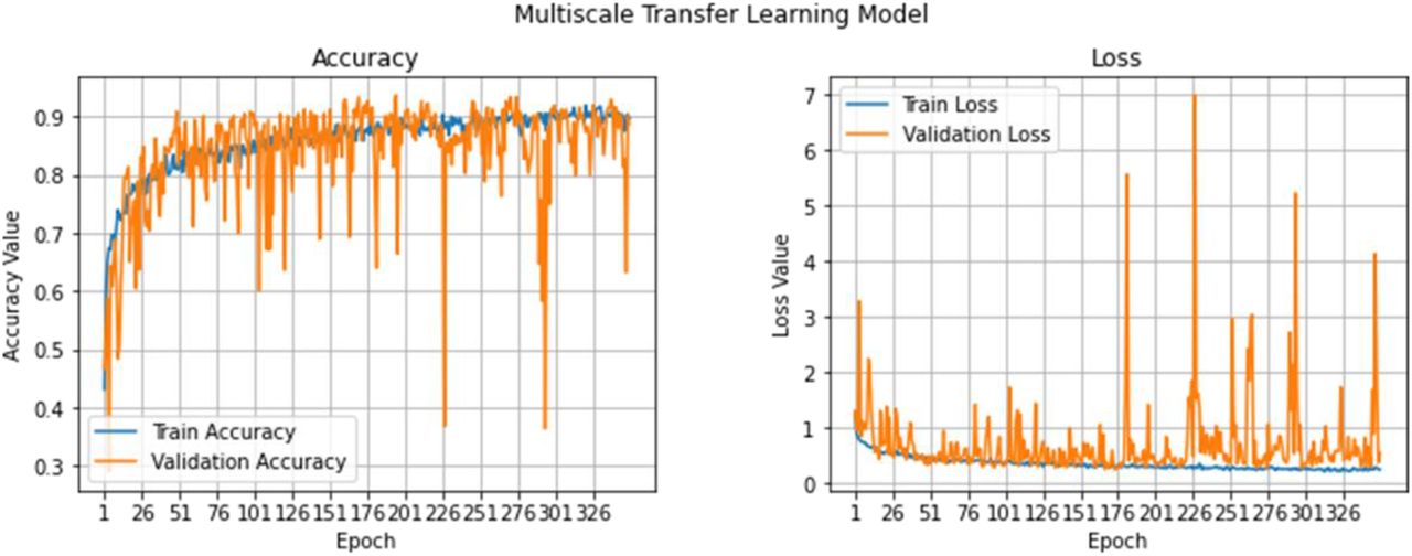 Training progress for 4-class dataset: (Left) training and validation accuracy (higher is better), and (Right) training and validation loss (lower is better)