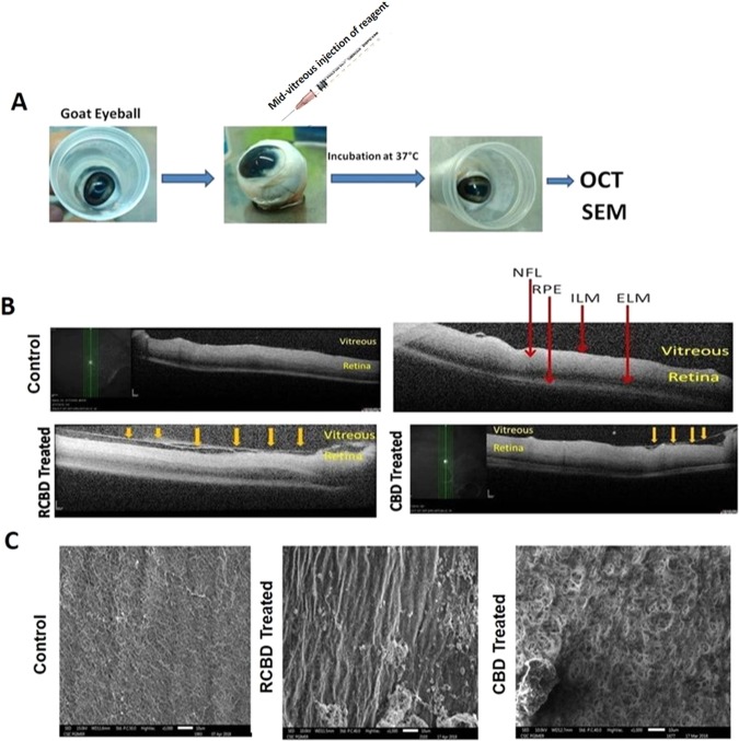 Ex-vivo OCT and SEM studies in goat eyeballs: (Panel A) Schematic representation of the experimental outline; (Panel B) Representative OCT images showing detachment of posterior hyaloid membrane of vitreous from the ILM of the retina upon treatment with 250 µg CBD or 350 µg RCBD (shown by arrows); no posterior vitreous detachment (PVD) was seen in the corresponding contralateral eyes; (Panel C) SEM micrographs showing dense vitreous fibrils on the retinal surface of control eye, which were cleared/disorganized upon treatment with reagents (**scale bar: 10 µm); (ELM: External Limiting Membrane, ILM: Inner Lining Membrane, NFL: Nerve Fiber Layer, RPE: Retinal Pigment Epithelial cells).