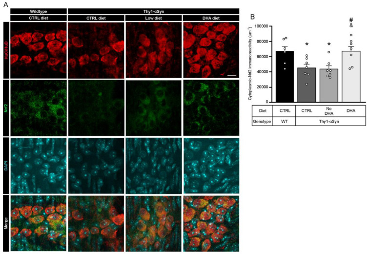 Augmentation of Nrf2 levels is associated with DHA-enriched diet. (A) Photomicrographs of HuC/HuD (red) and Nrf2 (green) immunofluorescence show colocalization of HuC/HuD and Nrf2 in the myenteric ganglions of Thy1-αSyn mice and their wild-type littermates. Maximum intensity projections are shown. Scale bar = 10 μm. (B) Immunoreactivity quantification of Nrf2 colocalizing with HuC/HuD (enteric neuron body) reveals lower levels of cytoplasmic-Nrf2 for the transgenic model on control and low ω-3 PUFA diets compared with wild-type animals. In contrast, mice maintained on the DHA-enriched diet show an increased Nrf2 level similar to wild-type mice (one-way ANOVA: p = 0.0040). Tukey’s post-hoc tests: * p < 0.05 compared with wild-type mice; # p < 0.05 compared with Thy1-αSyn on control diet; & p < 0.05 compared with Thy1-αSyn on the low ω-3 PUFA diet. Abbreviations: A.U., arbitrary unit; ChAT, choline acetyltransferase; CTRL, control; DHA, docosahexaenoic acid; Nrf2, nuclear (erythroid-2) related factor-2; TH, tyrosine hydroxylase; WT, wild-type. (white dots) show an increase of varicosities per 100 μm of dendrites in transgenic mice fed with DHA-enriched diet compared to control diet.