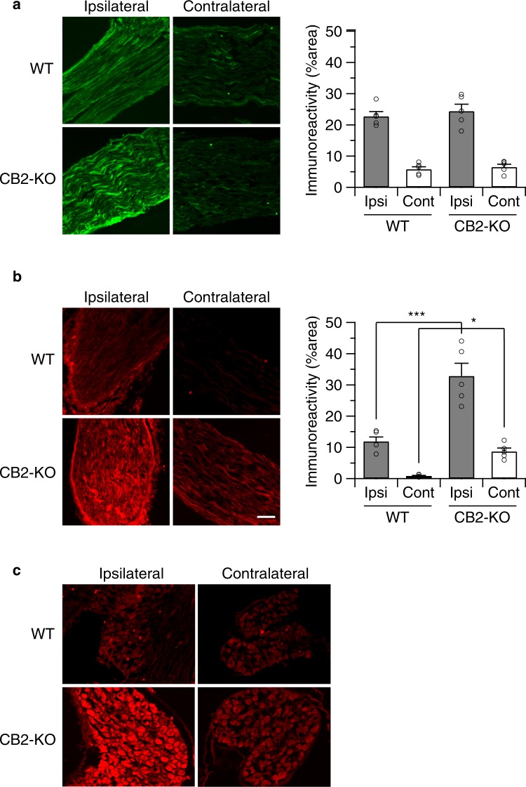 Leptin receptor expression was upregulated in nerve-injured CB2-KO animals 14 days after the surgery. Immunostaining of sciatic nerves using leptin (a) and leptin receptor (b) specific antibodies. Shown are the areas just next to the injured site (ipsilateral) or middle of dissected nerve (contralateral). Bars indicate a length of 100 μm. Leptin receptor expression was robustly increased in injured nerve of CB2-KO mice and a slight upregulation of leptin receptor expression was also observed on the contralateral nerve in CB2-KOs, but not in WT animals. The immunoreactivity was quantified (1 section/animal, n = 5) and expressed as percentage of positive signals to the stained area (mean ± SEM). A significant genotype effect is indicated by *p < 0.05 or ***p < 0.001, compared with respective WT controls (two-way ANOVA followed by Sidak’s multiple comparisons test). (c) A prominent induction of Leptin receptor expression was also observed in dorsal root ganglia of CB2-KO mice ipsilateral to the nerve injury.