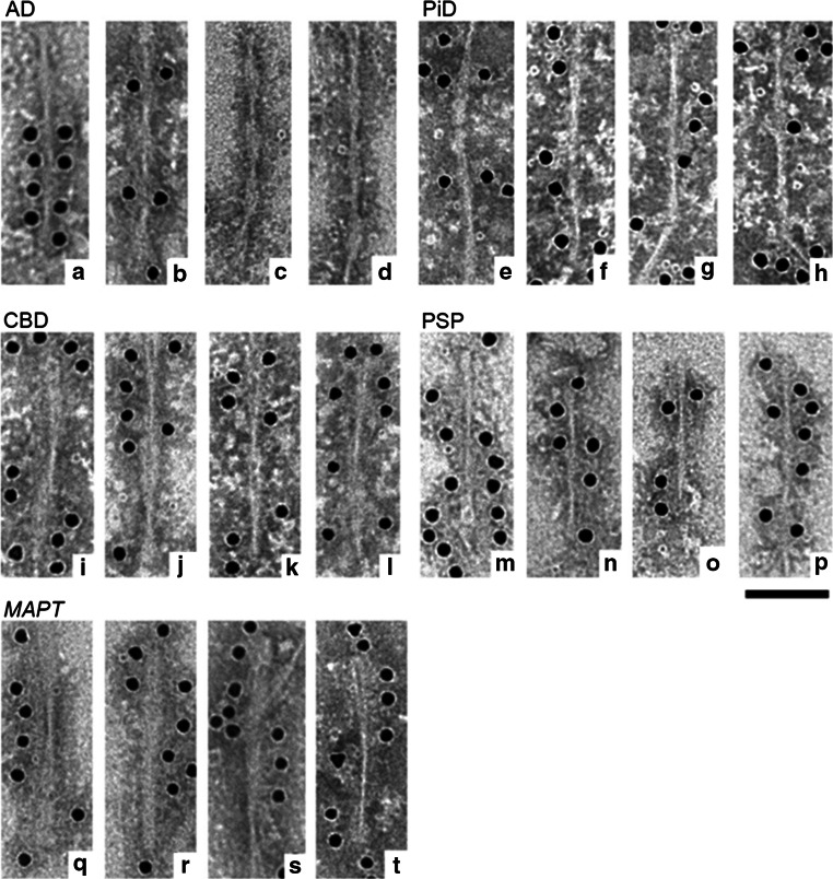 Electron microscopy of sarkosyl-insoluble tau from tauopathy brains. Electron micrographs of PHFs from AD brains, which were positive for T46 (a, b) which were labeled by secondary antibody conjugated to 15-nm gold particles. Similar PHFs were observed after trypsin digestion (c, d). T46-positive SFs were observed in PiD (e–h). Twisted filaments in CBD were positive for T46 (i–l). In PSP thin twisted filaments were labeled with T46 (m–p). In MAPT, ribbon-like filaments similar to those in CBD were observed (q–t)