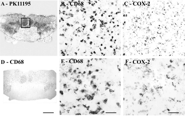 COX-2 immunoreactivity in ALS spinal cord found in microglial cells/macrophages predominantly in white matter. (A) Autoradiographic localisation of 3 [H] PK11195 in a spinal cord from a patient with ALS co-located with CD68 (D) (Scale bars = 1000 μm). The square indicates the area where subsequent CD68 and COX-2 images were taken from. B) And E) Microglial cells/macrophage -like immunostaining with CD68 antibody (Scale bars = 200 μm and 100 μm respectively). C) And F) Microglial cells/macrophage-like immunostaining with COX-2 (Scale bars = 200 μm and 100 μm respectively).