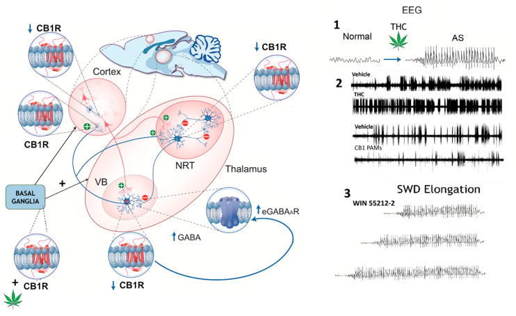 Schematic representation of cannabinoid receptor type 1 (CB1R) distribution in the rat thalamocortical circuit, illustrating region-specific changes in expression (↑ or ↓) and their impact on GABAergic signaling. CB1R expression is decreased in the cortex, thalamic relay neurons (VBs), basal ganglia, and key inhibitory synapses. In the thalamic reticular nucleus (NRT), reduced CB1R expression may contribute to thalamocortical hyperexcitability. Enhanced GABA release in the VB could increase extrasynaptic GABA_A receptor (eGABAAR)-mediated tonic inhibition, facilitating the generation of SWDs. Right panels—EEG recordings: 1. Phytocannabinoids (∆9-THC): THC-induced SWDs are hypothesized to result from CB1R activation at striatonigral synapses, which enhances GABA release and disinhibits oscillation-promoting neurons in the nigro-thalamic pathway, triggering SWDs even in previously non-epileptic animals. 2. In GAERS, ∆9-THC exacerbates SWDs by increasing their frequency and duration, while CB1R-positive allosteric modulators (PAMs) reduce SWD incidence. Cannabidiol (CBD) has been reported to suppress SWDs in animal models, although human studies suggest it may paradoxically increase SWD activity in some cases. 3. In WAG/Rij rats, the synthetic CB1R agonist WIN 55212-2 disrupts the termination (“stop”) mechanism of SWDs, likely via effects on the NRT, resulting in prolonged discharges without altering their incidence (see main text for references). Figure modified with permission from [229].