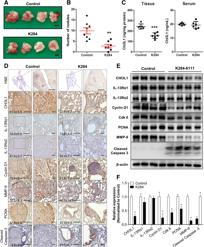 Effect of K284 on the metastasis of A549 cells to the lungs of C57BL/6 mice. (A) Images of lung metastasis of human lung cancer cells in BALB/c nude mice. A549 human lung cancer cells were injected in BALB/c nude mice that were then intravenously administered via the tail vein saline (left) or 0.5 mg·kg−1 K284 (right) at 3‐day intervals for 8 weeks. n = 8 for the control group; n = 7 for the K284‐treated group. Scale bar, 2 mm. (B) The number of tumor nodules in mouse lung tissues was counted. n = 6. **P < 0.01 (vs. control). (C) The tissue and serum levels of CHI3L1 were analyzed by ELISA. n = 6. ***P < 0.001 (vs. control). (D) H&E staining of lung tissue sections. Immunohistochemical analysis for CHI3L1, IL‐13Rα1, IL‐13Rα2, cyclin D1, MMP‐9, PCNA, and cleaved caspase‐3 in lung tissue sections. The percentage of positive cells in immunohistochemistry staining was calculated and shown in the images. Scale bar, 50 μm. (E, F) Western blot analysis for CHI3L1, IL‐13Rα1, IL‐13Rα2, cyclin D1, Cdk 6, PCNA, MMP‐9, and cleaved caspase‐3 from the lung tumor metastatic tissue lysate. The relative protein expression in the K284‐treated group compared with that in the control group is shown in the graphs. *P < 0.05 vs. control. All error bars of graph reported are the standard deviation (SD) from three independent experiments.