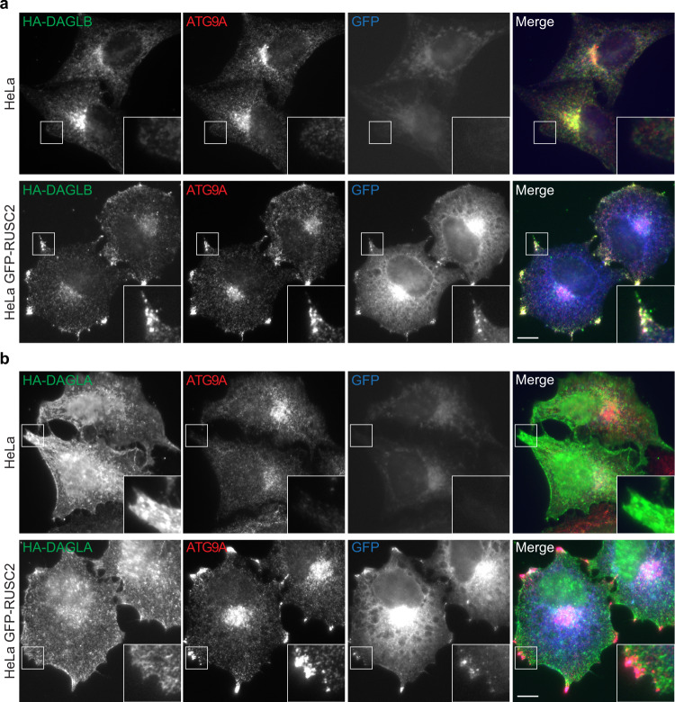 Unlike DAGLB, DAGLA is not rerouted in an AP-4 cargo redistribution assay.a Widefield imaging of wild-type HeLa or HeLa cells stably expressing GFP-RUSC2 (blue), transiently expressing HA-DAGLB, and labelled with anti-HA (green) and anti-ATG9A (red). HA-DAGLB has a very similar localisation to ATG9A in both cell lines. The insets show the rerouting of HA-DAGLB to peripheral ATG9A- and RUSC2-positive puncta in cells overexpressing GFP-RUSC2. Scale bar: 10 µm. b Widefield imaging of wild-type HeLa or HeLa cells stably expressing GFP-RUSC2, transiently expressing HA-DAGLA, as in (a). HA-DAGLA has a different localisation to ATG9A and does not reroute to the peripheral puncta in cells overexpressing GFP-RUSC2. Scale bar: 10 µm. For (a) and (b), images are representative of at least 18 images per condition, including three independent transfections with microscopy performed independently for each.