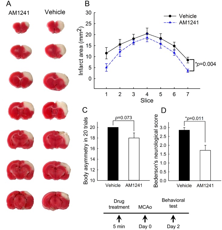 Pretreatment with CB2 agonist AM1241 reduced behavioral deficits and brain infarction in stroke rats.Rats were treated with AM1241 (2.5 mg/kg, n = 7) or vehicle (n = 7) at 5-min prior to MCAo. (A) Representing TTC histology taken at day 2 after MCAo indicates that the size of the lesion was reduced in an animal receiving AM1241. (B) The area of infarction in brain slices was quantified every 2 mm from the rostral end. AM1241 significantly reduced brain lesion (p<0.001, two-way ANOVA+ Newman-Keuls test). (C, D) Neurological tests were evaluated on day 2 post-stroke. Pretreatment with AM1241 significantly reduced (D) Bederson’s neurological scores (p = 0.011) and (C) marginally mitigated body asymmetry (p = 0.073).