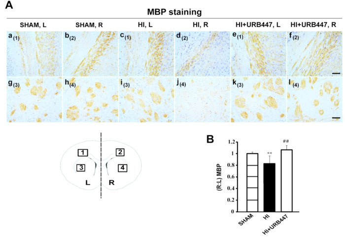 Modulation of myelin basic protein (MBP) staining by neonatal hypoxia-ischemia (HI) and treatment with URB447 in the striatum. (A) Light microphotographs illustrating the disruption of MBP immunostaining in the external capsule (a–f) and adjacent striatum (g–l). Samples were obtained from 14-day-old rats subjected to sham operation (SHAM; a, b, g, h) or to HI on P7 and treated with either vehicle (HI; c, d, i, j) or URB447 (HI+URB447; e, f, k, l). (B) Densitometric analysis performed as described in the Materials and Methods section. L, left side, contralateral; R, right side, ipsilateral to occluded carotid artery. Bar, 100 μm. ** P < 0.01 vs Sham group, ## P < 0.01 vs HI group, one-way ANOVA (N = 8/group).