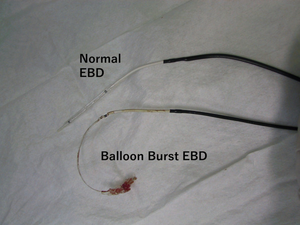 The burst balloon of the EBD catheter. The burst balloon of the EBD catheter is shown in comparison to a normal balloon of an EBD catheter