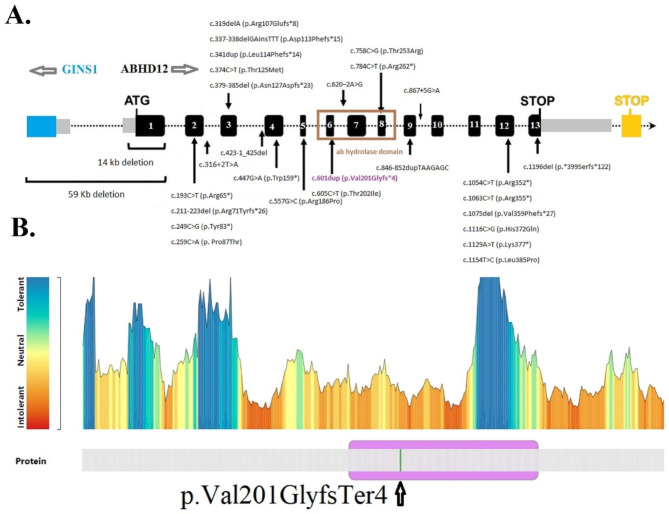 Gene and protein structure. (A) Intron-exon structure of ABHD12 and location of all mutations found up to now. Twenty-nine mutations in ABHD12 associated with PHARC syndrome have been found. The new frameshift variant, c.601dup, is indicated by the purple color in ab hydrolase domain which is indicated by brown color. Black rectangles and black lines represent exons and introns, respectively. ABHD12 has 13 exons. The only difference between the two isoforms is in their last exon, which is indicated by two stop codons in the picture (black frame, isoform 1, and orange frame, isoform 2). Gray rectangles indicate 3′UTR and 5′UTR rejoin. The blue rectangle shows GINS1 gene next to ABHD12 gene. In the 59Kb deletion removes the exon 1 of ABHD12 and exons 1–4 of GINS1 and both promoters. The gray arrows on the top of the image indicate the orientation of the genes. The figure is redrawn from ref [38] (B) MetaDome [31] was used to recognize the intolerant regions in the ABHD12 protein