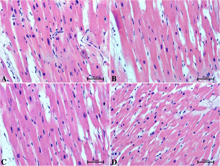 The heart section of patients under 50 years old a men b women and over 50 years old c men d women, H&E staining
