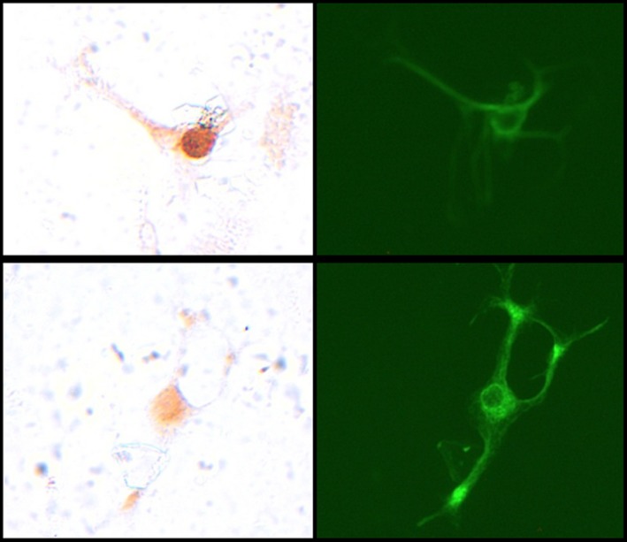 Photomicrographs of neurons stained for cFos (left panels) or neurofilament (right panels). The top panels illustrate a neuron staining positive for cFos. The bottom panels illustrate a neuron that is negative for cFos.