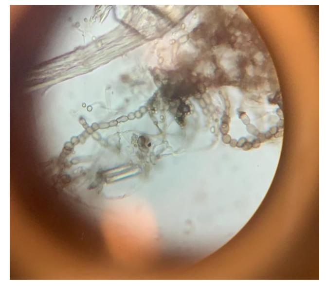 Aureobasidium mold sample A1 in a microscope.