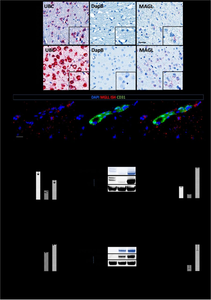 MAGL is expressed in the human and mouse cortex and is active at the level of the NVU (endothelial cells, astrocytes and pericytes).(A) Confirmation of MAGL mRNA expression by in situ hybridization (RNAScope) in human and mouse cortical brain tissue sections. Representative images show human and mouse brain cortical sections hybridized with MAGL RNAScope probes, then treated with chromogenic Fast Red substrate used for the detection of UBC (positive control for RNA integrity), dapB (negative control) and MAGL mRNA. Tissue sections counterstained with hematoxylin (n = 2). Scale bar = 20 μm. MAGL mRNA is expressed in close proximity to but does not co-localize with endothelial cells. (B) Immunofluorescence of mouse brain tissue sections (previously hybridized with MAGL mRNA) stained with an anti-CD31 antibody (green) to label endothelial cells (n = 2). Scale bar = 20 μm. MAGL is expressed and active in NVU cells. Human (C-E) and mouse (F-H) BMECs (hCMEC/D3 or pMBMEC), primary astrocytes (pHA or pMA) and primary pericytes (pHP or pMP) were used to assess MAGL expression within the NVU. Relative MAGL gene expression levels in human (C) and mouse (F) NVU cells measured by droplet digital qRT-PCR. Relative MAGL gene expression is normalized to housekeeping gene EMC7 (n = 3, mean ± SD, one-way ANOVA with Tukey’s post hoc test, ns = not significant, *p < 0.05, **p < 0.01, ***p < 0.001, ****p < 0.0001). MAGL activity (ABPP) and total MAGL protein (western blot) in human (D, E) and mouse (G, H) NVU cells. Active MAGL was quantified as the average intensity of the total detectable MAGL signal divided by total MAGL protein/β-actin signal (n = 2, mean ± SD, one-way ANOVA with Tukey’s post hoc test, ns = not significant, *p < 0.05, **p < 0.01, ***p < 0.001, ****p < 0.0001).