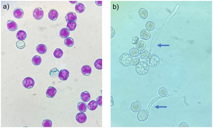 Differential staining and in vitro germination of Cannabis sativa pollen.(a) Differential staining of non-aborted (pink cytoplasm with blue exines) and aborted pollen grains (blue exines), showing absorption of pink acid fuchsin in the cytoplasm of functional pollen grains. (b) In vitro germination of viable and inviable pollen grains, showing protrusion of the pollen tube in viable pollen grains (blue arrows).