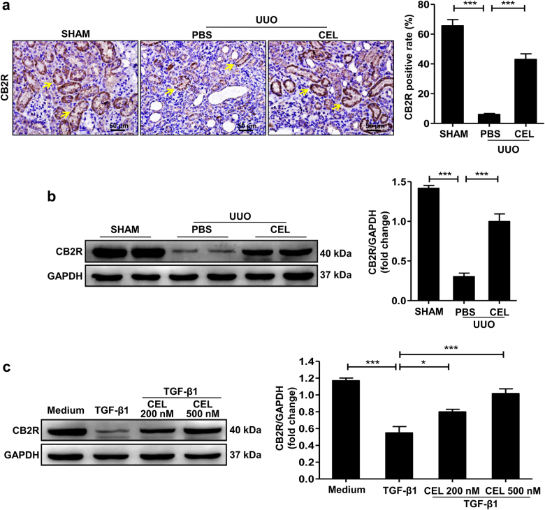 Celastrol upregulates CB2R expression during development of renal fibrosis.a, b Mice received celastrol (1 mg/kg) daily for 7 days from the day of surgery. The vehicle-treated mice were treated with an equal volume of PBS, and the sham group was the control for UUO. Kidney tissues were collected at 7 days after UUO. Representative results of immunohistochemistry and western blot of CB2R expression in the obstructed kidney tissue. Quantitative data were presented. c Serum-starved HK-2 cells were pretreated with or without indicated concentrations of celastrol for 1 h and then stimulated with TGF-β1 (10 ng/ml) for 24 h. Representative western blots and quantification data of CB2R expression in HK-2 cells were presented. The medium group was used as the control for TGF-β1 treatment. Results are representative of three replicate experiments. All values are represented as mean ± SEM. Scale bar = 50 μm. n = 5/group. *P < 0.05 and ***P < 0.001