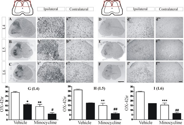 Chronic minocycline treatment attenuates the spinal nerve ligation-induced increase in OX-42 immunoreactivity (ir) in the lumbar spinal cord. Vehicle (A, B, C, sterile water) or minocycline (D, E, F, 30 mg/kg, ip) was injected daily for 14 days and spinal cords dissected and processed for immunohistochemical detection of OX-42ir at the level of L4 (A-a" and D-d"), L5 (B-b" and E-e") and L6 (C-c" and F-f"). High magnification images of the dorsal area used for OX-42ir signal quantification are also shown. Histograms (G-I) showing effects of minocycline or vehicle in L4-L6 spinal cord OX-42ir (white bars: ipsilateral side; black bars: contralateral side) are shown at the bottom. Data are expressed as mean ± SEM (n = 12 sections from 4 rats per group). Data were analysed using Kruskal Wallis non-parametric test followed by Dunn's multiple comparison posthoc analysis, * P < 0.05, ** P < 0.01, *** P < 0.001 vs ipsilateral-veh, # P < 0.05, ## P < 0.01 vs contralateral-vehicle. Scale bars: F = 1 mm (applies to A-F); f' = 100 μm (applies to a'-f' and a"-f").