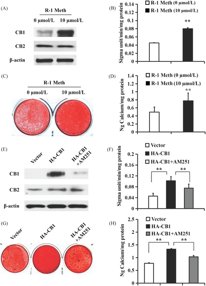The function of R‐1 Meth and AM251 on osteo/dentinogenic differentiation in PDLSCs. A‐D, 10 µM R‐1 Meth was used to treat PDLSCs. A, Western blot results showed the expression of CB1 and CB2 in PDLSCs after treatment with 10 µM R‐1 Meth for 4 h. β‐actin was used as an internal control. B, The ALP activity assay. C, Alizarin Red staining. D, Calcium quantitative analysis. E‐H, 10 µM AM251 was used to treat the CB1‐overexpressing PDLSCs. E, Western blot results showed the expression of CB1 and CB2 in PDLSCs after treatment with 10 µM AM251 for 4 h. β‐actin was used as an internal control. F, ALP activity assay. G, Alizarin Red staining. H, Calcium quantitative analysis. Student's t test or one‐way ANOVA was performed to determine statistical significance. Error bars represent the SD (n = 3). **P ≤ .01