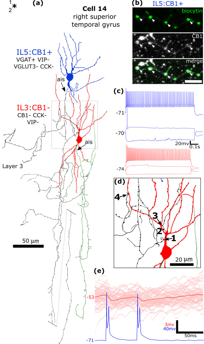 A CB1/VGAT‐immunopositive interneuron (IL5, blue) innervates a CB1‐negative interneuron (IL3) in layer 2/3 of the human right superior temporal gyrus. (a). Reconstruction of the recovered parts of the cells with soma and dendrites (blue, IL5, cell 14 in Figure 8f; red IL3) and a low density, descending axons (black IL5; green IL3). The axon of the CB1‐positive interneuron IL5 contacts the dendrites of IL3 at four dendritic sites, framed area (1–4) shown in (d). The descending axon of IL5 is shown shifted radially (dotted line). Asterisk, border of layers 1 and 2. (b) Confocal microscopic image of the biocytin labelled axon and boutons (green) of cell IL5 showing CB1‐immunoreactivity (arrows). Maximum intensity projections of optical slices, Z‐stack total depth: 2.4 μm. (c) Voltage responses of the cells to current injections close to rheobase, RB + 100 pA (upper traces), and holding current −100 pA; no voltage sags were detected to the hyperpolarising current injection. (e) Single sweeps (pink, n = 50) and average synaptic response (red line) of cell IL3 to action potentials of IL5 (single sweep) show a relatively small IPSP. The presynaptic CB1 + neuron fired doublet spikes to a 10 ms depolarising current pulse, and both spikes contributed to evoking the IPSP. Scale bar: (b), 5 μm.