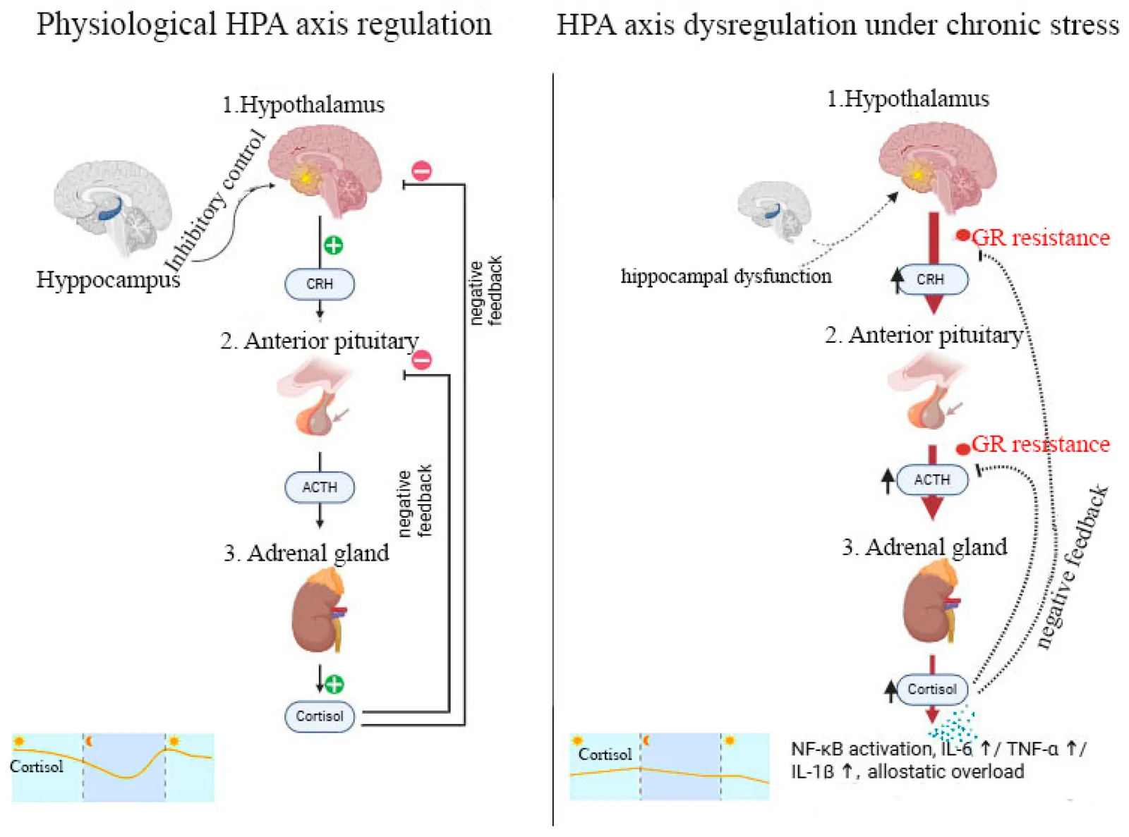 Transition from adaptive HPA axis regulation to chronic stress-induced neuroendocrine dysregulation. The figure illustrates activation of the hypothalamic–pituitary–adrenal (HPA) axis under physiological conditions (left panel), with hypothalamic corticotropin-releasing hormone (CRH) signaling, pituitary adrenocorticotropic hormone (ACTH) release, and adrenal cortisol secretion regulated by glucocorticoid-mediated negative feedback at the hypothalamus and pituitary, with additional hippocampal inhibitory control, maintaining circadian cortisol rhythmicity and systemic homeostasis. The (right panel) depicts HPA axis dysregulation under chronic stress, where prolonged glucocorticoid exposure impairs negative feedback sensitivity, promotes glucocorticoid receptor resistance, and disrupts hippocampal inhibitory control, resulting in flattened or dysregulated cortisol rhythms. Sustained HPA axis activation is associated with increased inflammatory signaling, including nuclear factor kappa B (NF-κB) activation and elevated pro-inflammatory cytokines (IL-1β, IL-6, and TNF-α), contributing to a maladaptive neuroendocrine–immune feedback loop and allostatic overload.