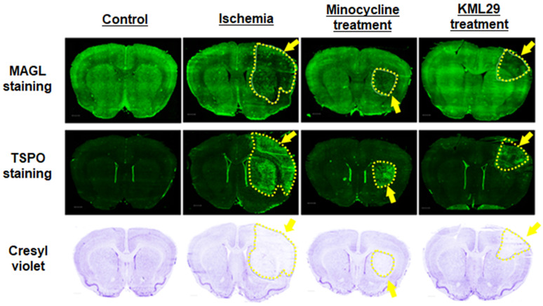 Histological analysis of the neuroprotective effect of medication. A-D: Immunofluorescence staining for MAGL in brain sections of control, ischemia, minocycline-treated, and KML-29-treated rats. E-H: Immunofluorescence staining for TSPO in brain sections of each rat. Cresyl violet I-L: staining for neurons in coronal brain sections of each rat. Yellow indicates neuronal injured areas. Scale bar: 1 mm.