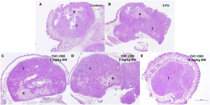 Histopathological morphology of mice in the negative control group (A), the positive control group (5-FU) (B), and THC:CBD at dose of 1 mg/kg BW (C), 5 mg/kg BW (D), and 10 mg/kg BW (E), (HE, 2×). Tumor masses were presented with necrotic tissue (N). Necrotic tissues were presented in the center and at the edge of the tumor especially in treatment and positive control groups compared with the negative control group.