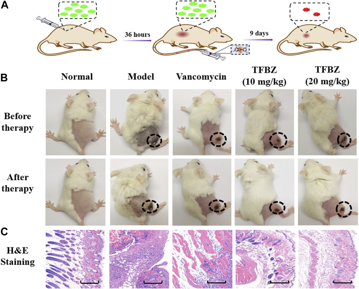(A) Timeline and course of treatment with TFBZ in mice infected with MRSA. (B) Typical photographs of infected mice before and after 9 days of treatment by PBS, Vancomycin, TFBZ (10 mg/kg) and TFBZ (20 mg/kg). (C) H&E staining images of the infected tissues with different treatments. Scale bar is 10 μm.