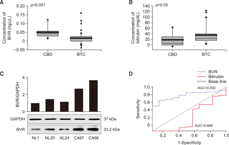Comparative changes in BVR and bilirubin levels in the bile of patients with CBD stones and BTC. (A) BVR activity. (B) Bilirubin level. The number of patients in each group was indicated as follows. BVR activity (CBD, n=14, BTC, n=56), Bilirubin level (CBD, n=11, BTC n=53). (C) Protein level and relative expression of BVR. (D) ROC analysis of BVR and bilirubin. GAPDH levels were measured to confirm equal protein loading. Patients were in two groups (n=11–56/group). All data are presented as means ± SD.