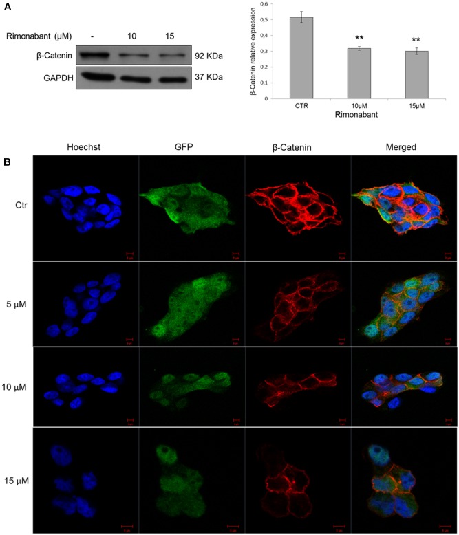 (A) Representative Western blot analysis (left) of β-Catenin in total protein lysates from GTG7 cells. Right, densitometric analysis of β-Catenin normalized vs. GAPDH, used as loading control. Results are expressed as means ± SD of 3 independent experiments performed at least in duplicate (∗∗p < 0.01). (B) Confocal microscopy analysis of β-Catenin (red) in GTG7 cells treated with Rimonabant at indicated doses for 18 h. Nuclei were stained with Hoechst (blue fluorescence); GFP (green); Scale bar = 5 μm.