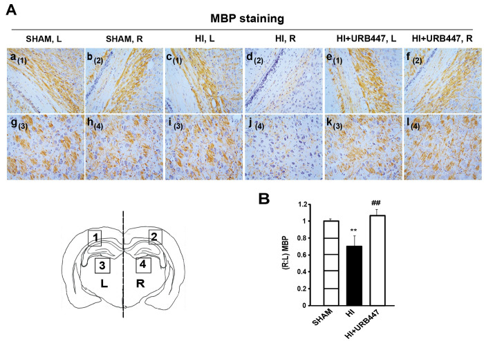 Modulation of myelin basic protein (MBP) staining by neonatal hypoxia-ischemia (HI) and treatment with URB447 in the mid-dorsal hippocampus. (A) Light microphotographs illustrating the disruption of MBP immunostaining in external capsule (a–f) and adjacent striatum (g–l). Samples were obtained from 14-day-old rats subjected to sham operation (SHAM; a, b, g, h) or to HI on P7 and treated with either vehicle (HI; c, d, i, j) or URB447 (HI+URB447; e, f, k, l). (B) Densitometric analysis performed as described in the Materials and Methods section. L, left side, contralateral; R, right side, ipsilateral to occluded carotid artery. Bars, 100 μm. ** P < 0.01 vs Sham group, ## P < 0.01 vs HI group, one-way ANOVA (N = 8/group).