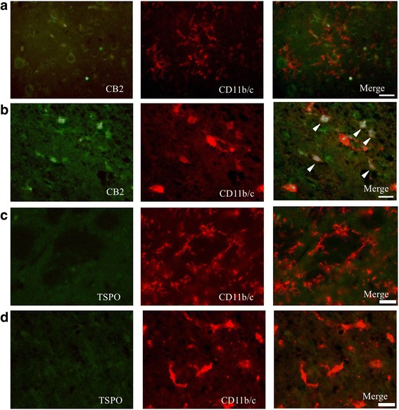 Double-immunostaining for CB2 and CD11b/c in the contralateral (non-lesion) (a) and the peri-infarct (b) areas and for TSPO in the contralateral (c) and peri-infarct (d) areas on day 1 after PIT treatment. Several microglia were co-stained for CB2 and CB11b/c (arrowhead). Scale bar, 25 μm