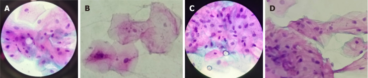 Data on micronucleus occurrence. A: Conventional smokers (moderate occurrence); B: Marijuana smokers (low occurrence); C: Reverse smokers (abundant occurrence); D: E-cigarette smokers (moderate occurrence).