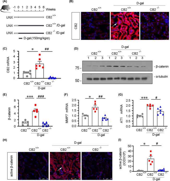 β‐catenin signalling is inhibited by CB2 gene ablation in d‐gal‐treated mice. (A) Experimental design. Black bar indicated that mice were administered subcutaneous injections of d‐gal at 150mg/kg/day for 6 weeks after surgery for 1 week. UNX: unilateral nephrectomy. (B) Representative micrographs showing renal expression of CB2 in different groups. Cryosections were subjected to fluorescence in situ hybridization (FISH) staining for CB2. Arrow indicates positive staining. scale bar, 25 μm. (C) Quantitative real‐time PCR results showing renal expression of CB2. *p < 0.05 versus WT mice group alone; ## p < 0.01 versus the d‐gal‐treated WT mice group alone (n = 5–6). (D and E) Representative Western blot and quantitative data showing renal expression of β‐catenin. Numbers (1–3) indicate each individual animal in a given group. ***p < 0.001 versus WT mice group alone; ### p < 0.001 versus the d‐gal‐treated WT mice group alone (n = 5–6). (F and G) Quantitative real‐time PCR results showing renal expression of MMP7 and AT1. *p < 0.05 and ***p < 0.001 versus WT mice group alone; # p < 0.05 and ## p < 0.01 versus the d‐gal‐treated WT mice group alone (n = 5–6). (H) Representative micrographs showing the expression of active β‐catenin. Frozen kidney sections were stained with an antibody against active β‐catenin. Arrow indicates positive staining. Scale bar, 75μm. (I) Quantitative data showing quantification of positive staining. *p < 0.05 versus WT mice group alone; # p < 0.05 versus the d‐gal‐treated WT mice group alone (n = 5–6)