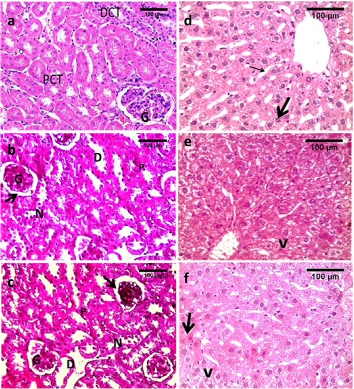 Photomicrographs of liver and kidney sections of WIN55, 212–2 treated mice and controls. Control and vehicle groups: a & d, low dose groups: b & e and high dose groups: c& f. Image a shows normal kidney, proximal convoluted tubule (PCT), distal convoluted tubules (DCT) and glomeruli (G). Image b low dose groups showing some degenerative histological changes in the kidney compared to controls. Image c changes are more pronounced in the high dose groups with shrinkage of glomeruli (G). Changes in b &c were in the form of tubular epithelium degeneration and necrosis (N), tubular dilatation (D) with dilatation of urinary space in Bowman’s capsule (arrow) and pyknotic nuclei (p). Image d shows normal hepatocytes with acidophilic cytoplasm (thick arrow) and blood sinusoids in between hepatocytes (thin arrow). Image e reveals vacuolated cytoplasm of hepatocytes (v) in low dose groups. Image f display vacuolated hepatocytes (v) in high dose and some nuclei are pyknotic (arrow). Stain H&E (scale bar = 100 um)