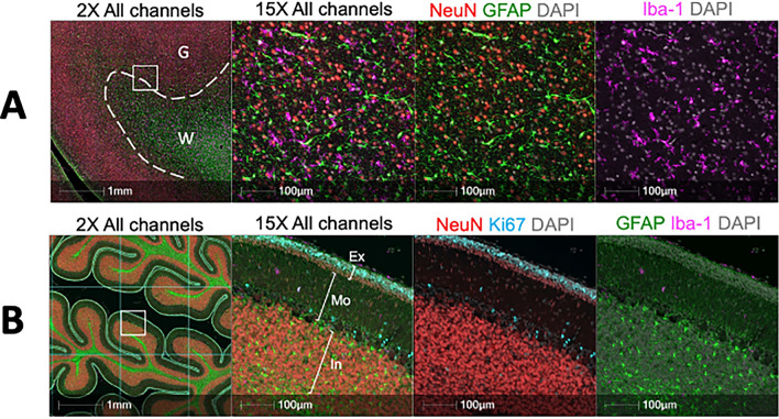 A Multiplex immunofluorescence of the fetal prefrontal cortex. FFPE sections were stained for neurons (NeuN—Red), microglia (Iba-1—Magenta) and astrocytes (GFAP—Green) by multiplex immunofluorescence. Dotted line in 2× panel represents the boundary between grey matter (G) and white matter (W) as differentiated by NEuN and GFAP staining. B Muliplex immunofluorescence image of the fetal cerebellum. FFPE sections were stained for neurons (NeuN—Red). Microglia (Iba-1—Magenta), Ki67 (Cyan) and astrocytes (GFAP—Green) by multiplex immunofluorescence. The external granule layer (Ex), Molecular layer (Mo) and internal granule layer (In) are highlighted in the 15× panel. For quantification, the tissue was divided by a grid and annotations representations representing each layer were drawn in 10 randomly selected grid squares per cerebellum.