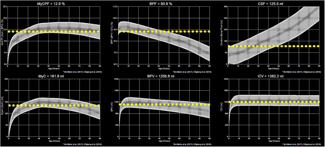Demonstration of post-processing available from SyMRI combined with 3D-QALAS at high isotropic resolution in a healthy volunteer. Shown are the myelin parenchymal fraction (MyCPF), brain parenchymal fraction (BPF), cerebral spinal fluid (CSF), myelin content (MyC), brain parenchymal volume (BPV), and intracranial volume (ICV) in the healthy volunteer in their 20s. The dashed yellow line is the measured content while the grey bands are the predicted reference values for healthy individuals.