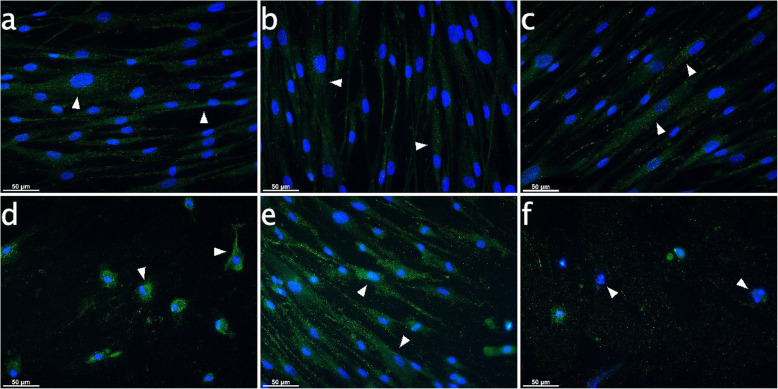 IBA-1 expression in PDL cells subject to CB receptor agonist modulation with or without CII for 6 h. Immunocytochemical analyses for IBA-1 (green) after 6 h stimulation revealed inherent expression in cultured PDL cells. The IBA-1 signals were distributed equally in the cytoplasm for controls and with or without endocannabinoid treatment (arrowheads on Fig. a, b, c), exhibiting dotted structures. IBA-1 MFI values increased in all groups after CII, although signal distribution concentrated around the nuclei due to changes in cell morphology and loss of cells (arrowheads on Fig. d, f). However, AEA was able to reverse effects aroused by CII, and even intensified IBA-1 signals. a: Control, b: AEA-treated (50 μM), c: PEA-treated (50 μM), d: 6 h CII, e: 6 h CII plus AEA-treated (50 μM), f: 6 h CII plus PEA-treated (50 μM). Visualization was performed with Alexa 488 (green) secondary antibody. Nuclei were stained with DAPI (blue). Scale bar is 50 μm