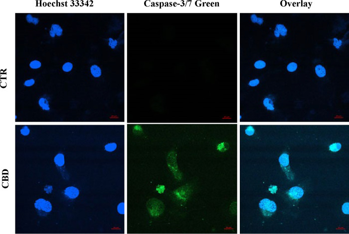 Effect of CBD on caspase 3/7 activation in PC3 cells.CBD treatment (10μM) for 48h led to the induction of caspase 3/7 activation (green color) of apoptotic pathways in most cells as determined by fluorescence imaging along with nuclear stain(blue). Scale bars were provided on the right side bottom of all images. A few cells also demonstrated apoptotic nuclei (fragmented blue).