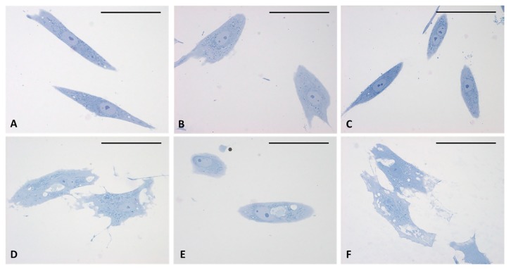 Semithin sections stained with 1% Toluidine blue. (A–C) control cells. (D–F) cells treated for 4 h with HU-308 2.5 µM. Treated cells contain vesicles and amorphous material (pale blue or white). Panel E shows a clearly exocytosed vesicle (*). Scale bars: 50 µm.